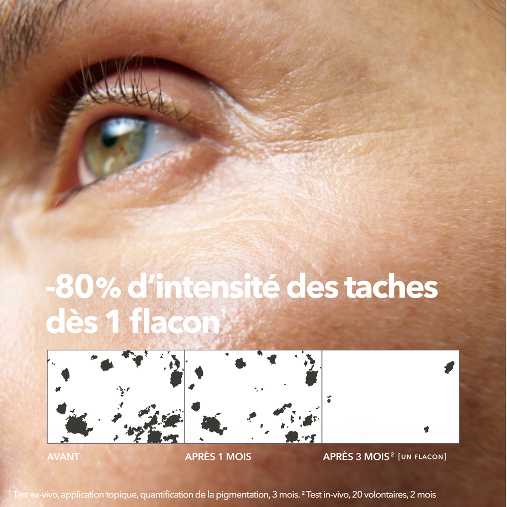 Sérum Concentré Anti-Taches